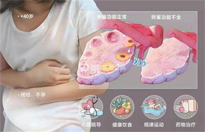 过了40岁AMH低就不好怀？错！忽略这一点，你可能白白焦虑了