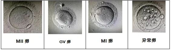 取卵多VS取卵少，哪个试管成功率更高？