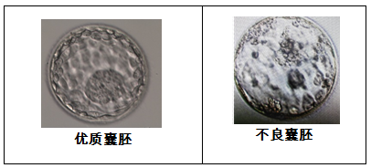 取卵多VS取卵少，哪个试管成功率更高？