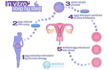 泰国试管婴儿流程具体是什么步骤