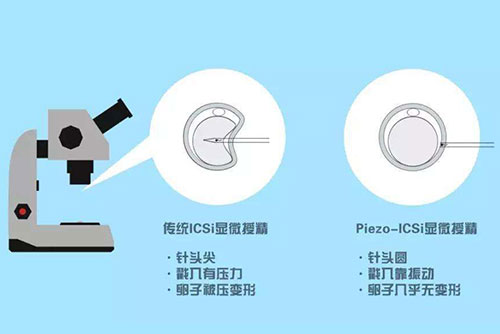 探讨泰国试管养囊技术的必要性？