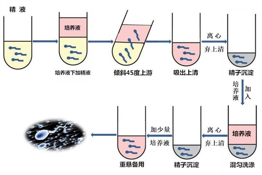 试管婴儿洗精术让HIV艾滋家庭好孕