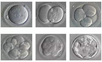 泰国三代试管婴儿养囊的秘密