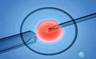 揭秘第二代试管婴儿技术——ICSI！