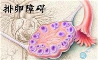 科学试管助孕帮您解决排卵障碍致不孕问题