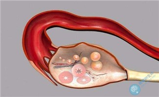 不孕的原因有哪些？未破裂卵泡黄素化得注意了