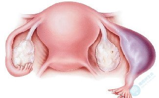 输卵管囊肿对做试管婴儿有影响吗？