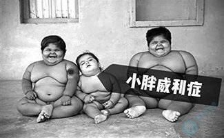 吃不饱的小胖威利症!做三代试管能避免吗? 吃不饱的小胖威利症!做三代试管能避免吗?