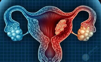 慢性子宫内膜炎怎么治疗?做试管可成功怀孕吗? 慢性子宫内膜炎怎么治疗?做试管可成功怀孕吗?
