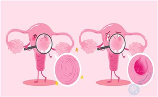 子宫内膜异位症去泰国做试管能成功怀孕吗?