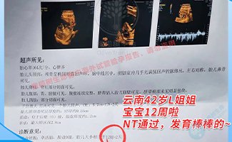 6年求子路，国内5次人授+试管取卵4次移植5次，均以失败告终，到泰国试管一次好孕！