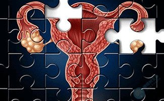 哪些疾病可能导致无排卵？生活中该如何避免？