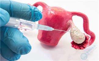 试管婴儿打促排针会不会有什么副作用？