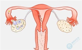 多囊卵巢的女性做试管婴儿是否更加具备优势呢？