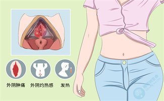 患有前庭大腺囊肿，可以做试管婴儿吗？