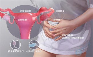 输卵管积水：胚胎着床的“隐形干扰者”与试管婴儿的破局之道