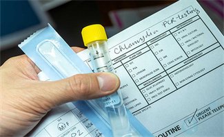 精子也会“过期”？这个检查窗口期要知道