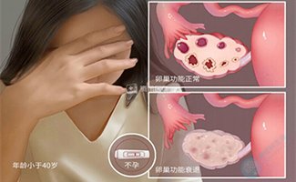 AMH下降不可逆!这4类伤卵习惯,试管备孕女性别忽视 AMH下降不可逆!这4类伤卵习惯,试管备孕女性别忽视
